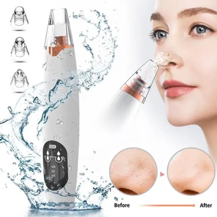 Aspirateur Point Noirs XPREEN - Extracteur de tête Noire Rechargeable - Nettoyage de la peau - Blanc