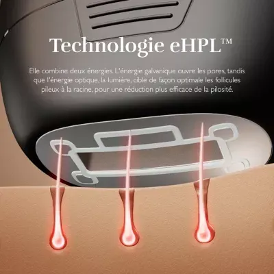 Silk'n - Epilateur Lumière Pulsée 7 — vue 6