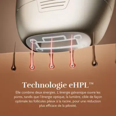 Silk'n - Epilateur Lumière Pulsée 7 Gold — vue 8